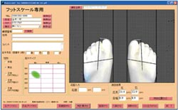 足形計測機 フットスケール：測定シート（分析結果）